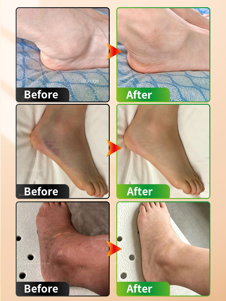 휴대용 발목 온열 마사지기, 무선 진동 온열 보호대,  - Ankle Mobility Band 리뷰 및 가격